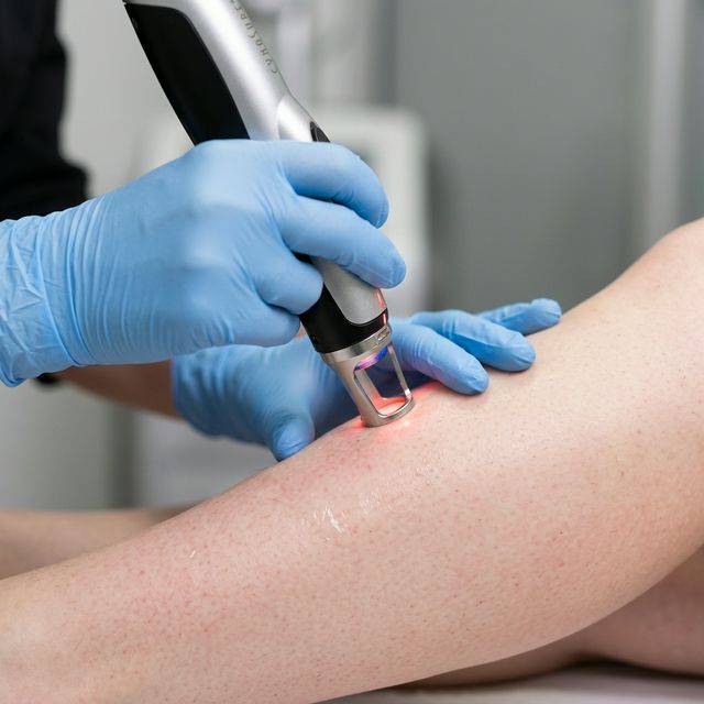 Dauerhafte Haarentfernung