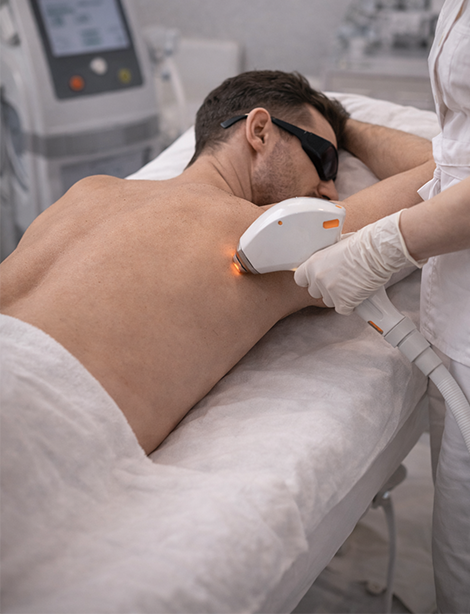 Dauerhafte Haarentfernung für Herren